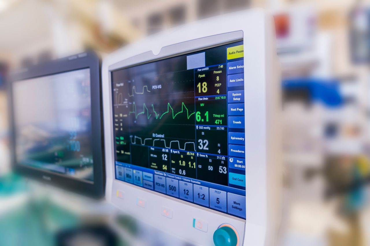 EKG Reading on Monitor