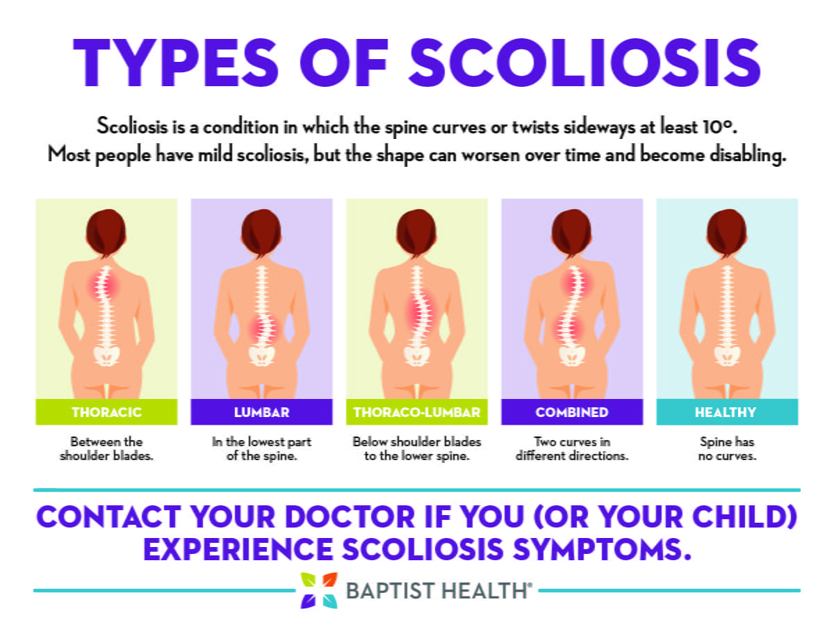 scoliosis types