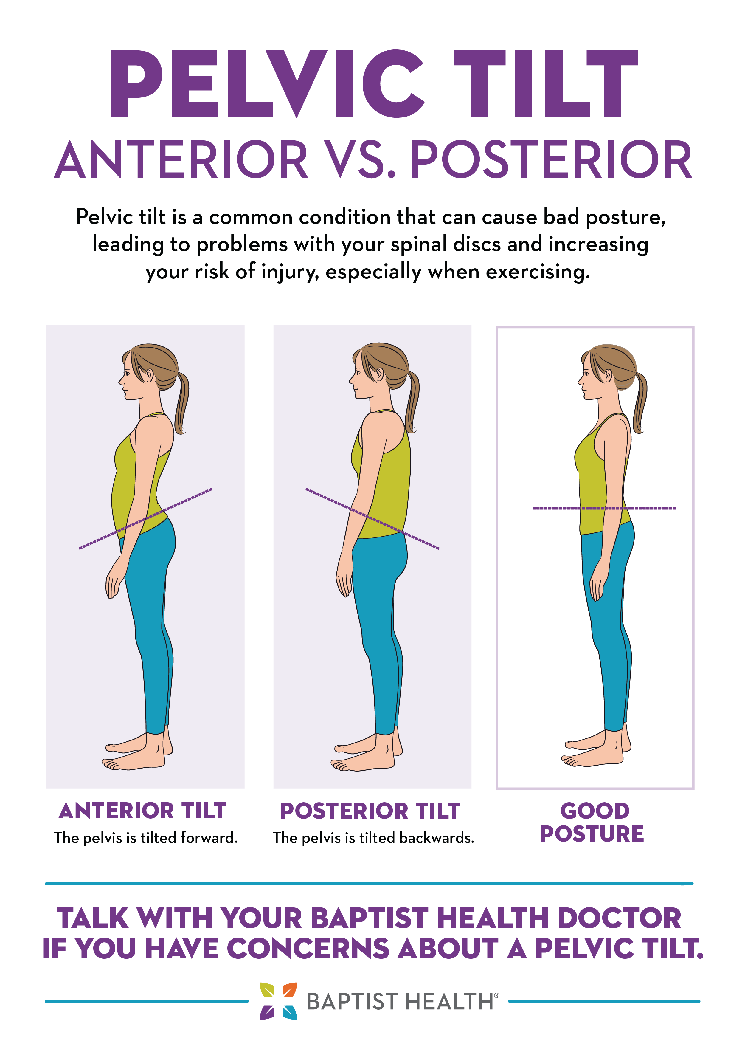 Anterior Pelvic Tilt