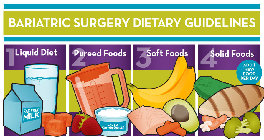 The Four Stages of a Post Bariatric Surgery Diet