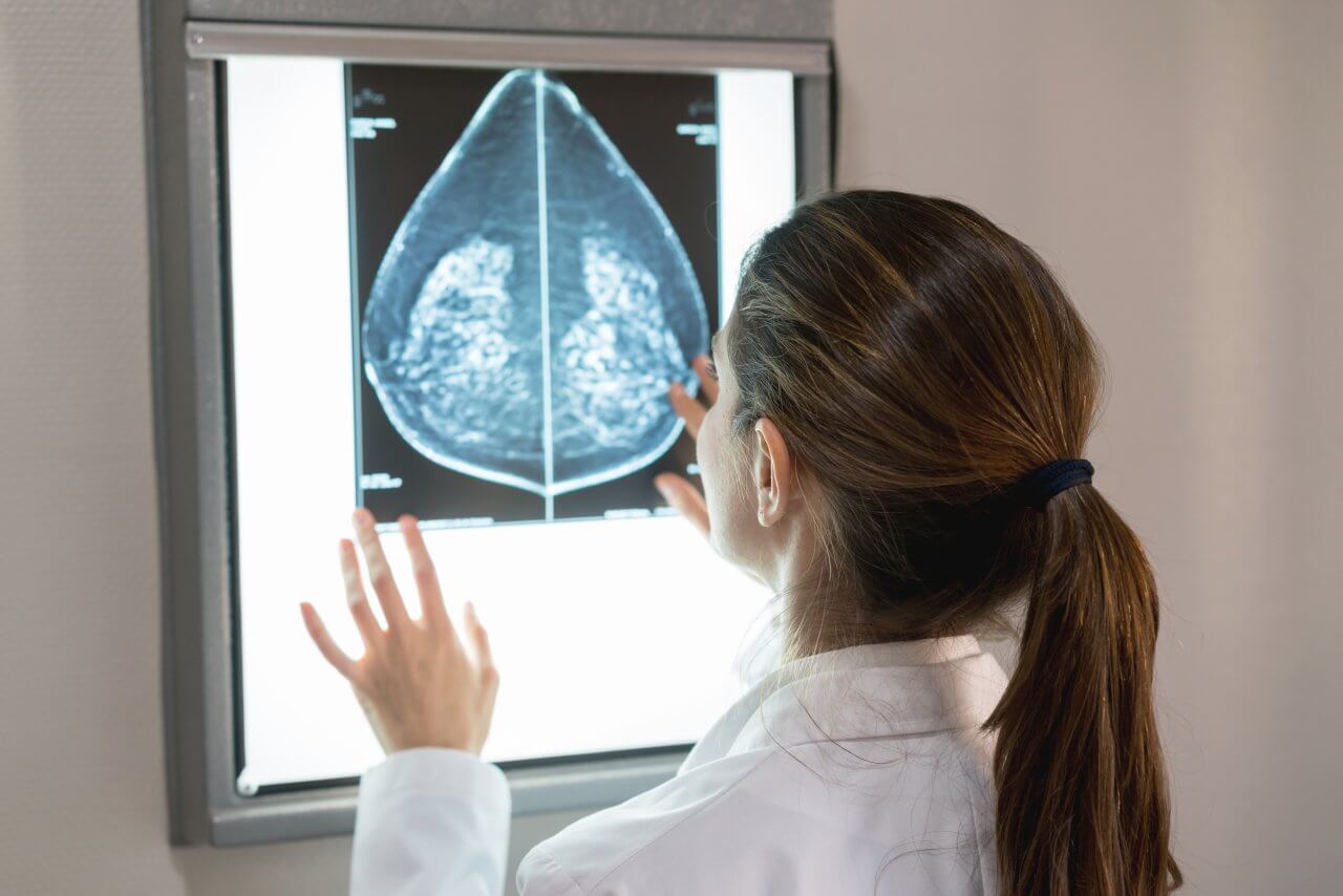 bi-rads score mammogram results