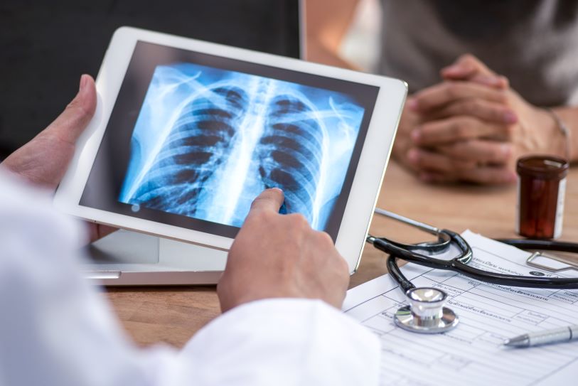 lung cancer screening